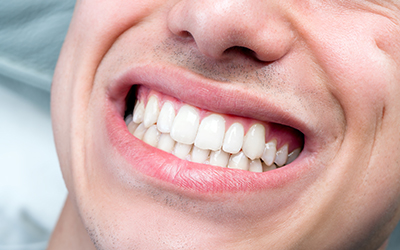 Up-close of a person smiling
